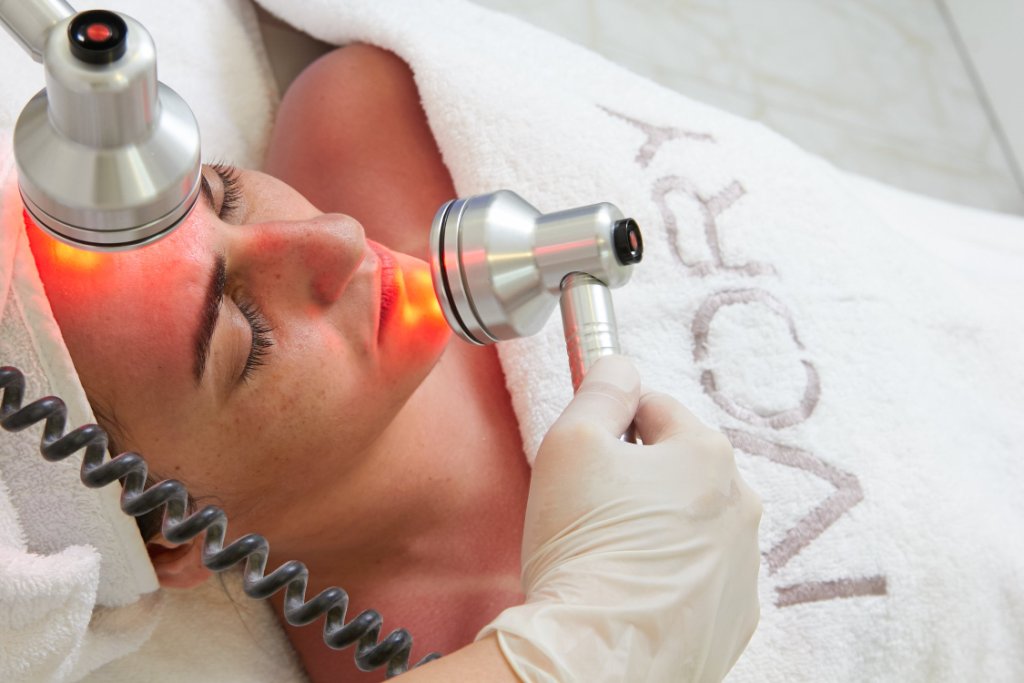 Radiofrequency facial – a client favorite for skin tightening